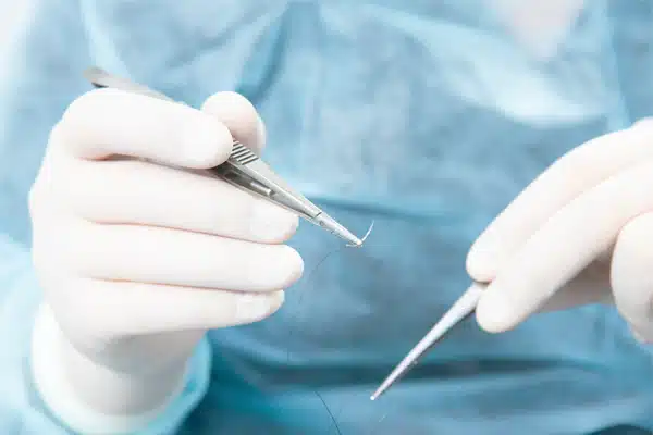 cirugia minímamente invasiva