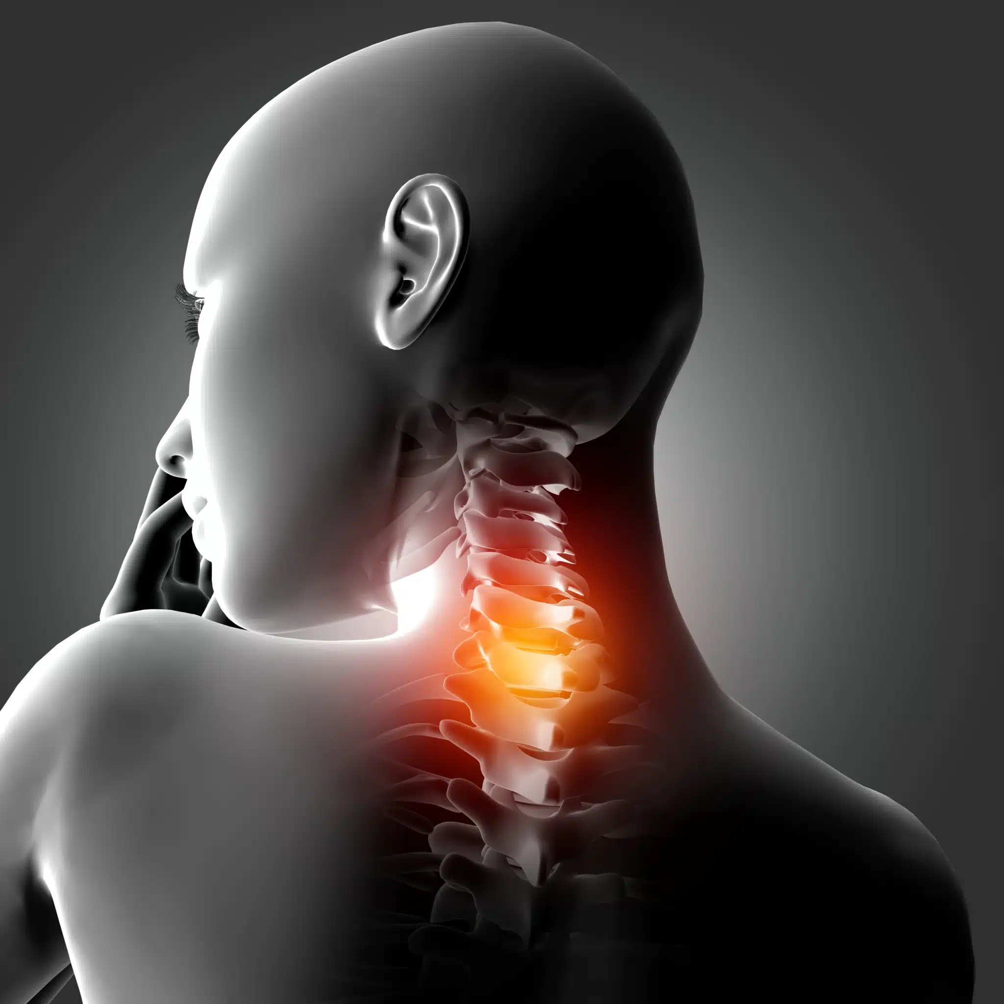 3d female medical figure with neck bones highlighted 11zon scaled - Hernia C5-C6