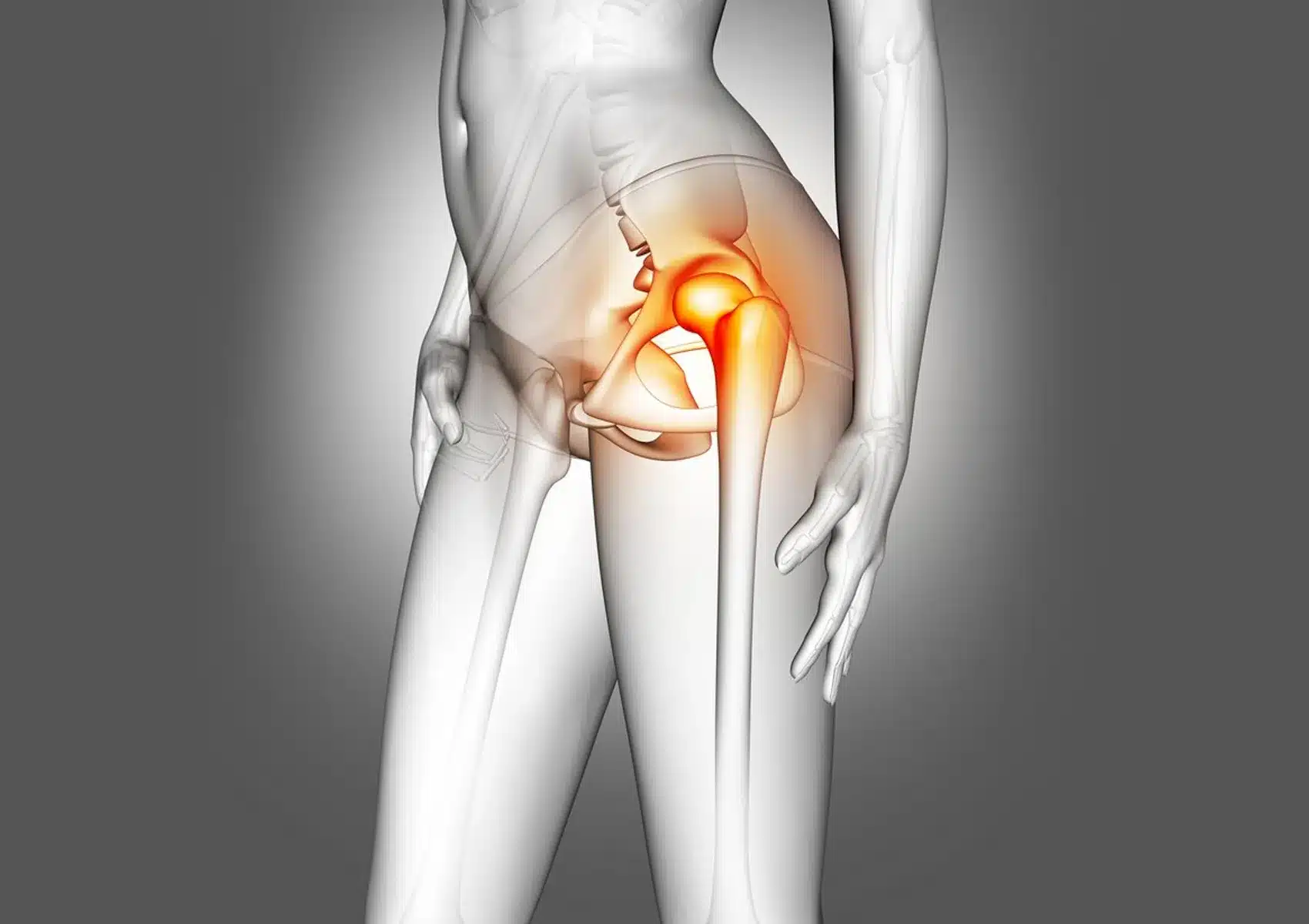 radiculopatia lumbar 11zon - Radiculopatia Lumbar