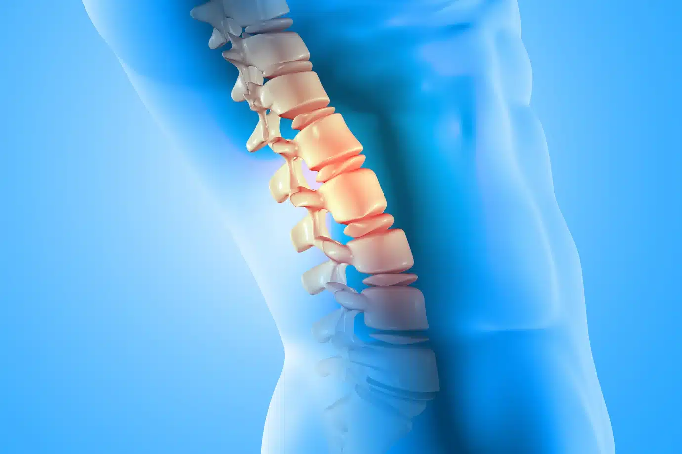 portada si tienes hernia discal l3 l4 - Todo lo que necesitas saber si tienes una hernia discal L3-L4