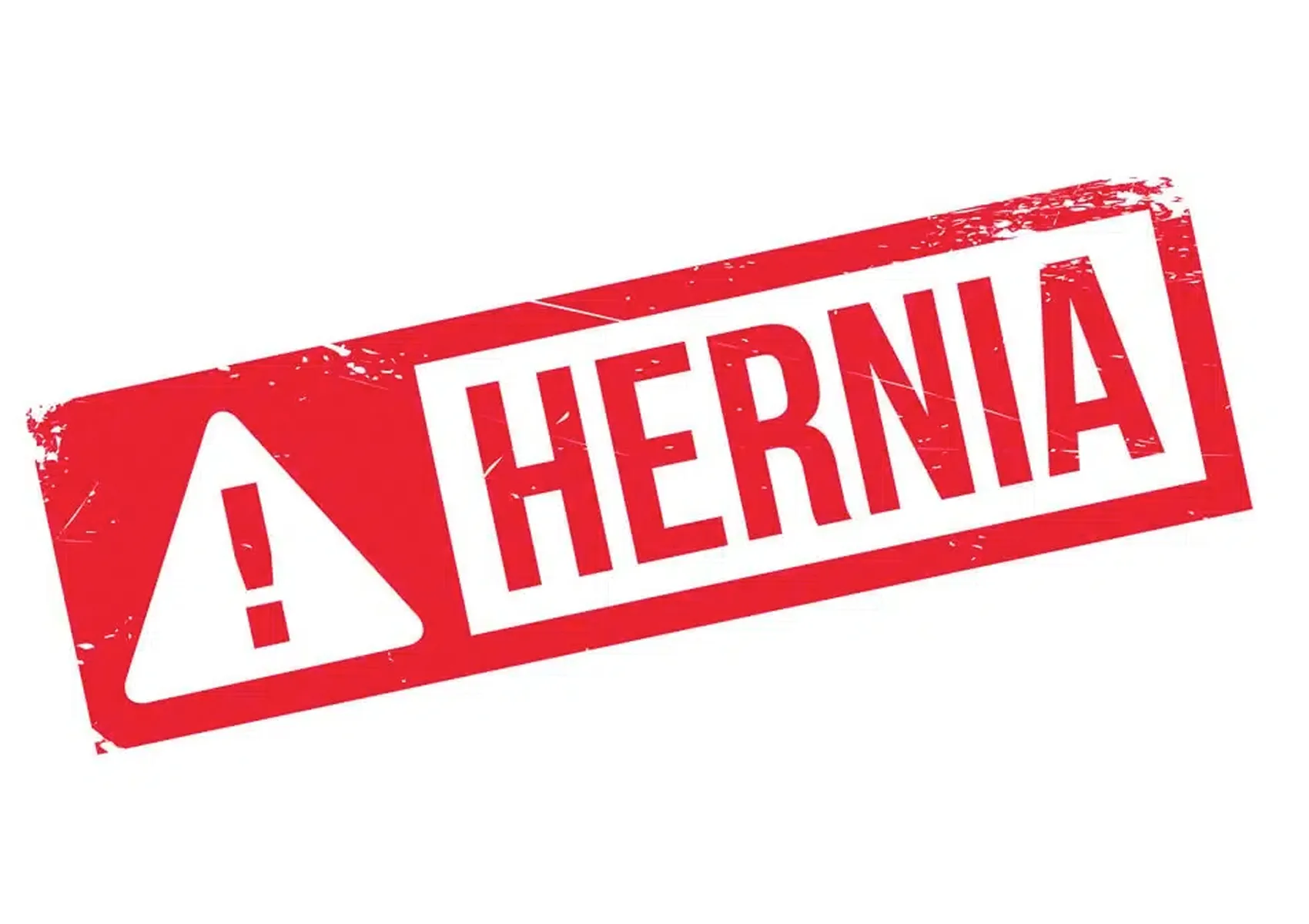 hernia grave.1647494041 11zon - Sintomas de hernia discal graves. Cuando debes  acudir a tu médico.