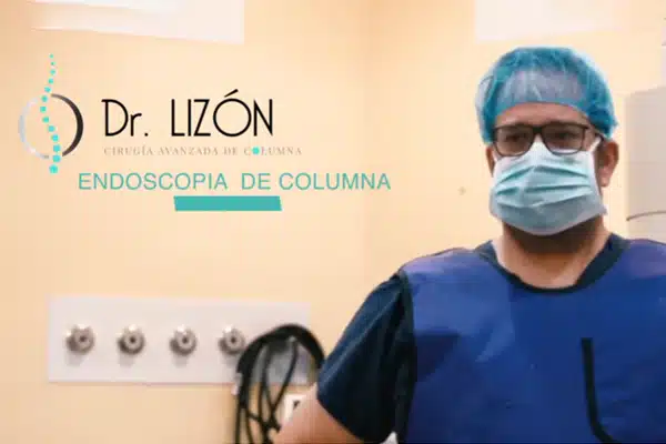 video endoscopia columna