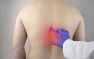1662653269 1 - Todo lo que necesitas saber sobre las hernias dorsales o torácicas