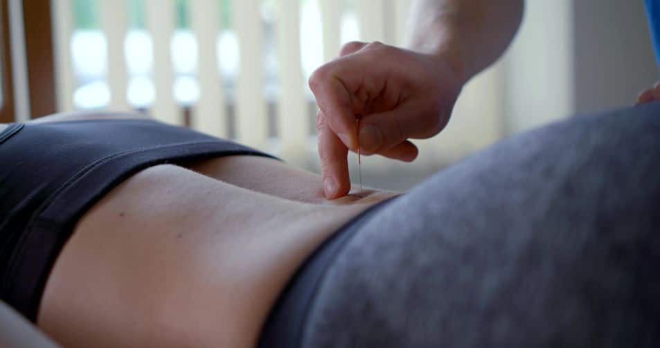 portada acupuntura.1620156632 - ¿Puede la acupuntura mejorar el dolor de espalda?