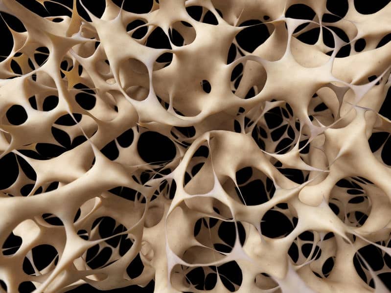 portada osteoporosisi y cirugia min.1644988146 - Cómo afecta la osteoporosis a la cirugía de raquis.