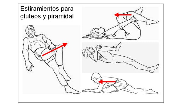 pseudociatica ii sindrome del gluteo medio 1512998091 1512999101 -  Sindrome del músculo gluteo medio