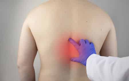 dorsal hernia symptoms