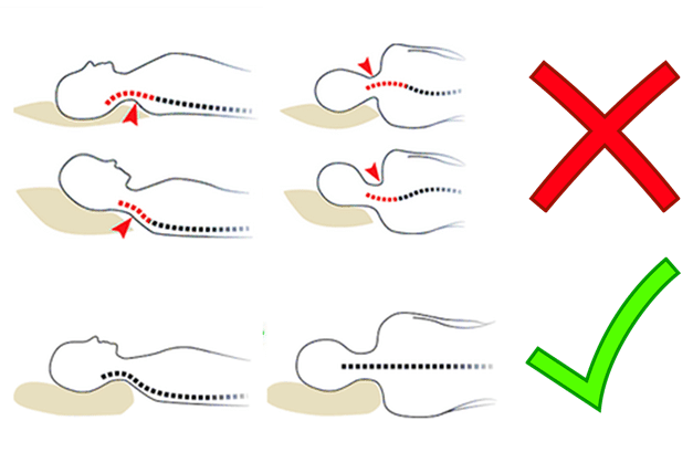 Posición durante el descanso para el dolor cervical