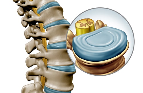 Intervertebral disc