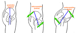 Ejercicios para el dolor lumbar