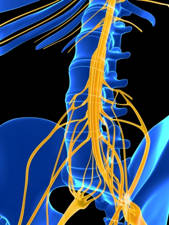 radiculopatia en paciente con escoliosis