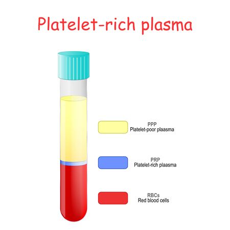 plasma rico en plaquetas