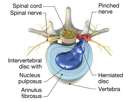 Nervio Sinuvertebral