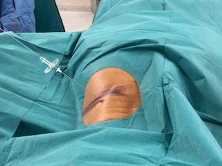 Tratamiento Dolor Discogénico