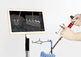 que es la cirugia navegada de columna 1629845066 1629845117 - Que es la cirugía navegada de columna
