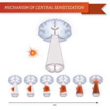 mecanismo sensibilizacion central