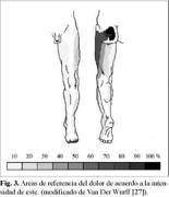 Origen del dolor sacroilíaco