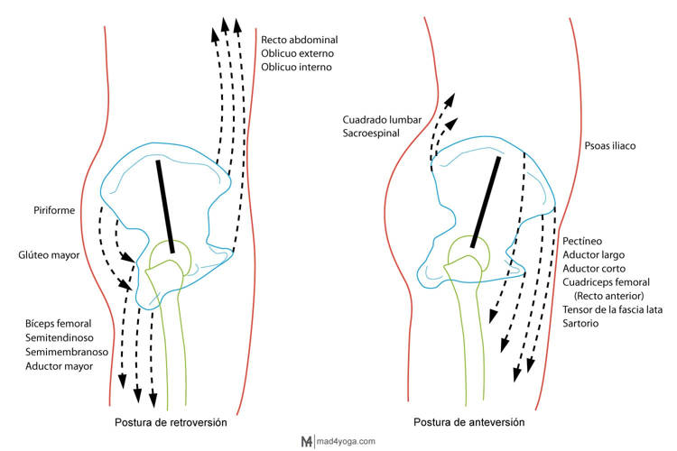 anteversion y retroversion y dolor lumbar